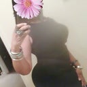 One month post op...no garment just a bra and thongs...i really didnt need the thongs;)