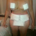 Day of my Surgery April 27