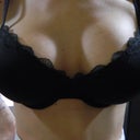 Day 8 PO Found this bra at Meijer for only $6 !! AND its a 36D !!!!!! YES! You can see the right breast is still swollen on top.