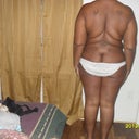 after, (back view) 6wks