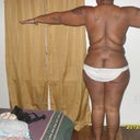 after, (back view) 6 wks