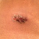Bellybutton pic 1- Day 9