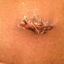 Bellybutton pic 2- Day 9