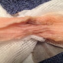 Another gross pic- This is how soaked the layers of gauze were each hour.- Day 9