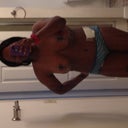 Still VERY swollen. But this is the first shot without the drain.- Day 9