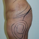 35 Year Old Mom Wnating More Fullness Of Her Buttocks.