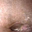 ok ladies you see how my belly button look it's driving me carzy I'm scare right now i don't kown what it is. It was looking perfect last week now it look like it's infected