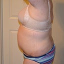 7 wks po left side