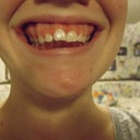 before. jan-4-2011