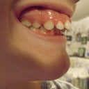 before. jan-4-2011