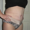 3 Weeks PO.  Totally swollen and was PMSing and in a very grumpy mood that day!