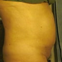 3 weeks. I have a belly-do! My belly no longer sticks out more than my boobie do.