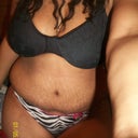 SO MUCH SWELLING STILL!!