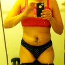 This is about 11 days post op