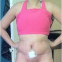 my tummy swollen and still a small hole but getting better