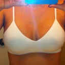 6 days post op-In Barely There Bra
