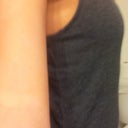 Side view in tank in underwire unpadded bra - pre surgery