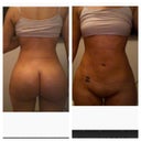 Love her results just want my hips wider :-)