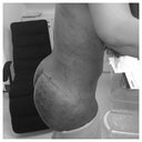 Swollen