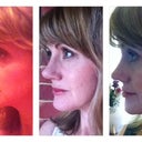 0 - 2 Months - left profile