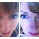 0 & 2 Months - downward nose shot.  Huge improvement, but there is a slight swing to the tip which concerns me.  I have read cartlidge has a memory.