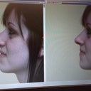 Computer Imaging