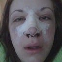 Day 2. More swollen & stuffy.