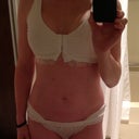 7 hours post op