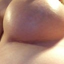 Right incision...again lighter in real life :)