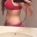 Right side.