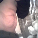 Leaning over now (: not quite so bad, pre-op