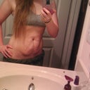 Down 10 pounds, pre-op
