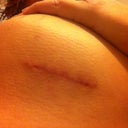 Scar... Is much more red/purple than I appears in this pic.