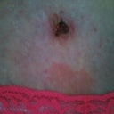 BB full of glue so looks yucky. 12 days po