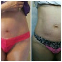 Still not standing straight in pink undies but same style as before photo.  (Before obviously on the right)