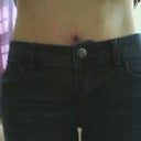 2 weeks po. In my preop skinny jeans. I can wear the binder comfortably in these too.