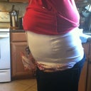 Post op day 1 and super swollen from lipo!