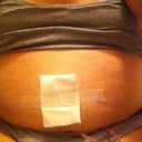 Post op day 7
