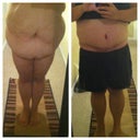 Before an after almost 1 month post op.