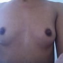 My front before BA, they got even Flatter after my last Baby that now is 1yr...