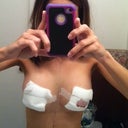 Front view from a little far, sorry about the blood. Im not aloud to remove or change them till monday.