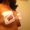 Side view so you ladies can see how much difference is there from my before flat chest!