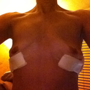Front Day of Surgery 3-20-13