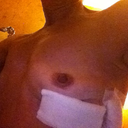 Left View Day of Surgery 3-20-13