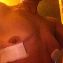 Right View Day of Surgery