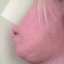 Here's the AFTER two week profile.