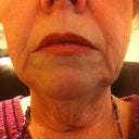 Before Big Turkey Neck and Jowls