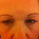 Before Hooded Eye Lids