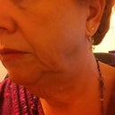 More Big Jowls and Turkey Neck