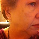 More Big Jowls and Turkey Neck